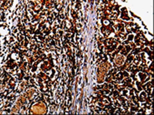 Anti-MMP13 Rabbit Polyclonal Antibody