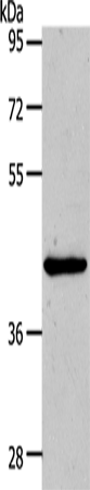 Anti-MMP13 Rabbit Polyclonal Antibody