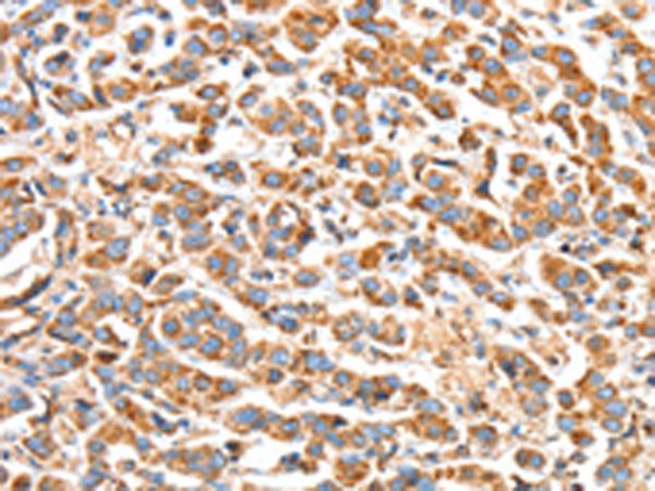 Anti-Bak Rabbit Polyclonal Antibody