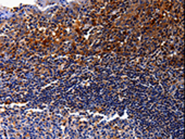 Anti-IL-10 Receptor alpha Rabbit Polyclonal Antibody
