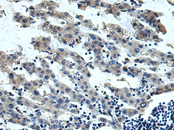 Anti-IL-13 Receptor alpha 1 Rabbit Polyclonal Antibody