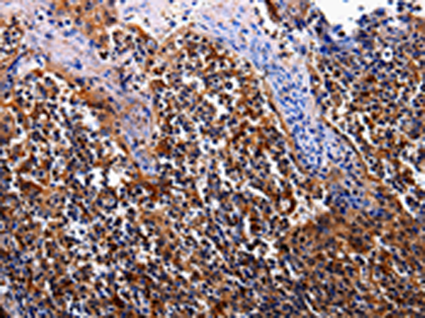 Anti-IL-17 Receptor C Rabbit Polyclonal Antibody