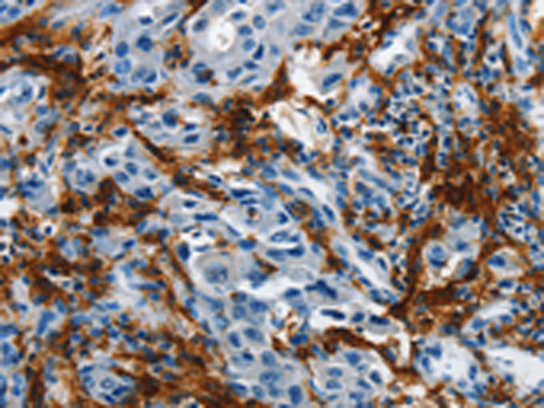 Anti-IL-20 Receptor alpha Rabbit Polyclonal Antibody