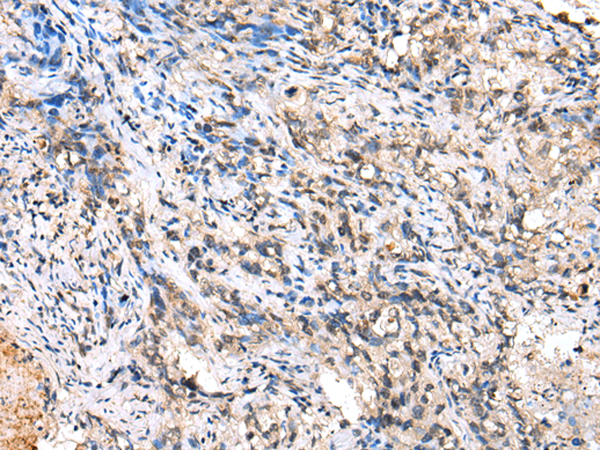 Anti-AAK1 Rabbit Polyclonal Antibody