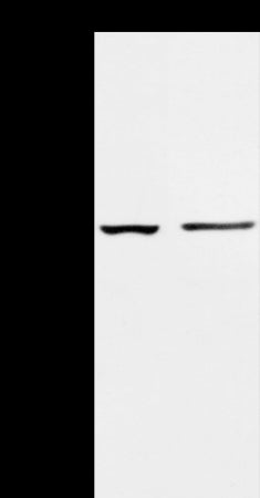 Anti-AAK1 Rabbit Polyclonal Antibody