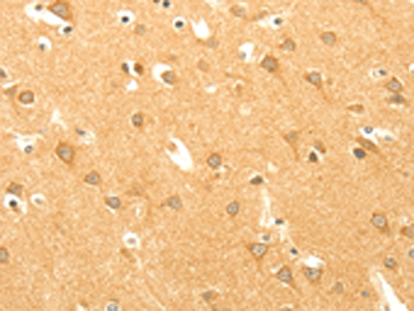 Anti-AARS2 Rabbit Polyclonal Antibody