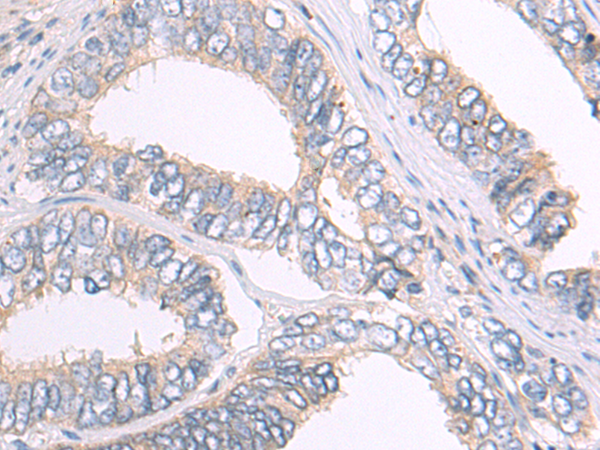 Anti-ADORA3 Rabbit Polyclonal Antibody