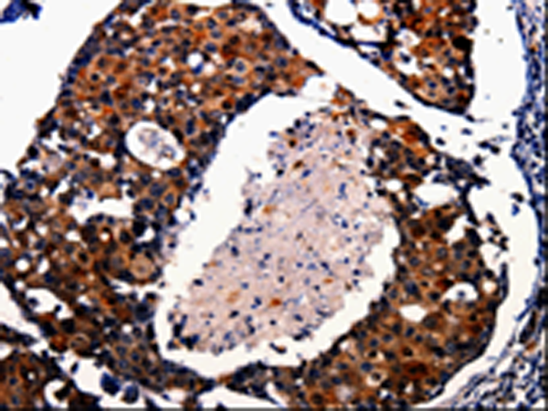 Anti-AK1 Rabbit Polyclonal Antibody