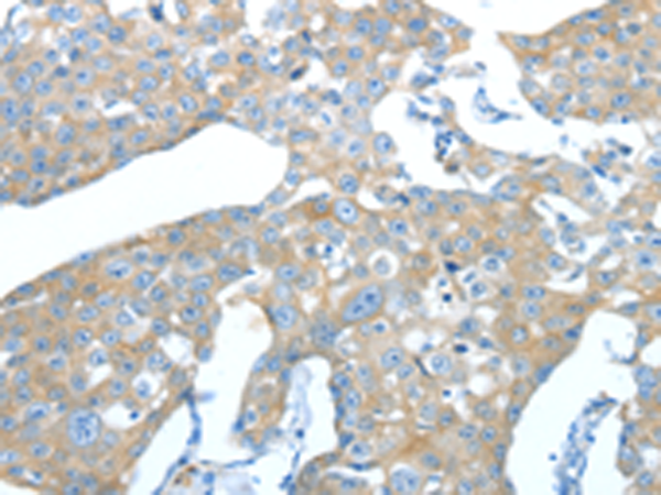 Anti-AMPH Rabbit Polyclonal Antibody
