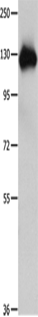 Anti-AMPH Rabbit Polyclonal Antibody