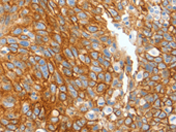 Anti-Cytokeratin 2e Rabbit Polyclonal Antibody