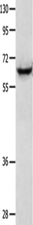 Anti-Cytokeratin 2e Rabbit Polyclonal Antibody
