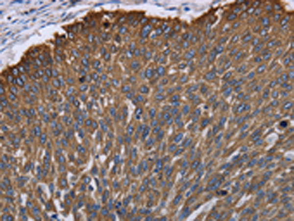 Anti-Keratin 31 Rabbit Polyclonal Antibody