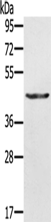 Anti-Keratin 31 Rabbit Polyclonal Antibody