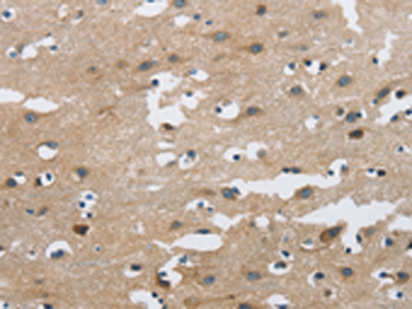 Anti-FGF9 Rabbit Polyclonal Antibody