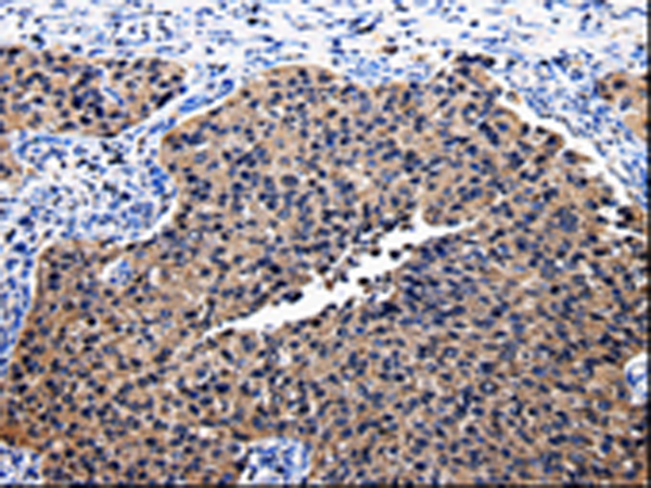 Anti-Bid Rabbit Polyclonal Antibody
