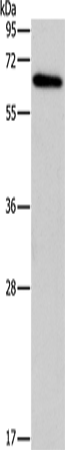 Anti-BIN1 Rabbit Polyclonal Antibody