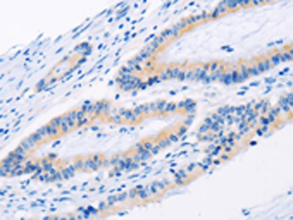 Anti-BMP3 Rabbit Polyclonal Antibody
