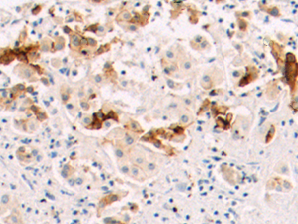 Anti-CAPN6 Rabbit Polyclonal Antibody