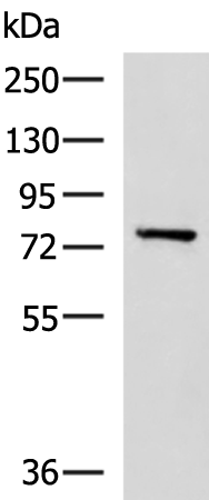 Anti-CAPN5 Rabbit Polyclonal Antibody