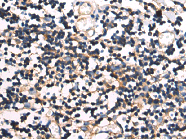 Anti-CAP1 Rabbit Polyclonal Antibody