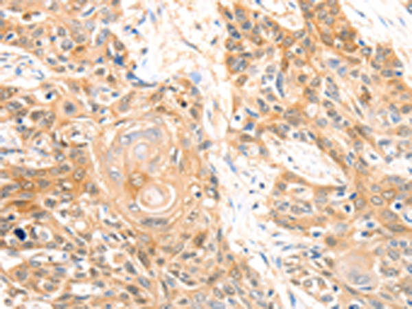 Anti-Carbonic Anhydrase 2 Rabbit Polyclonal Antibody