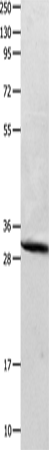 Anti-Carbonic Anhydrase 2 Rabbit Polyclonal Antibody