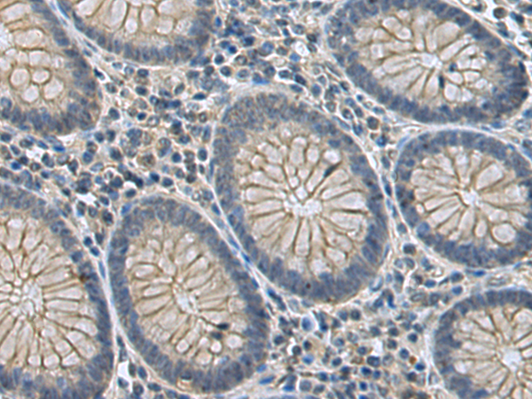 Anti-Carbonic Anhydrase 3 Rabbit Polyclonal Antibody