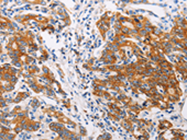 Anti-CTNNA1 Rabbit Polyclonal Antibody