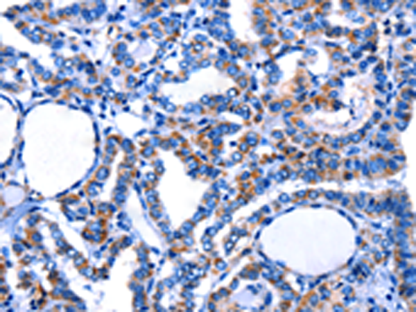 Anti-CTSH Rabbit Polyclonal Antibody