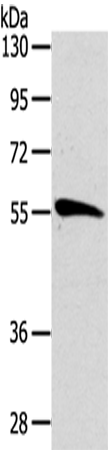 Anti-CDC25A Rabbit Polyclonal Antibody