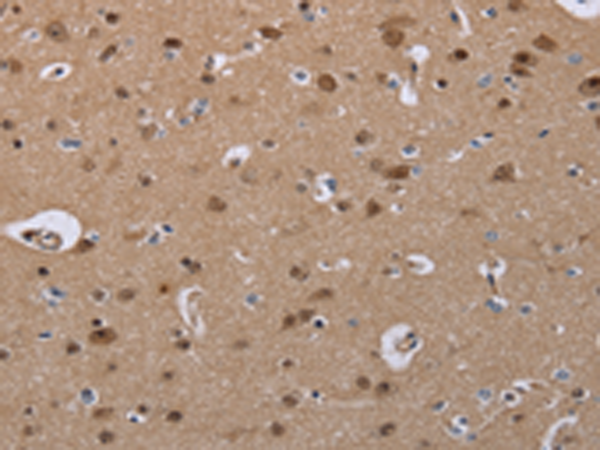 Anti-CDK5 Rabbit Polyclonal Antibody