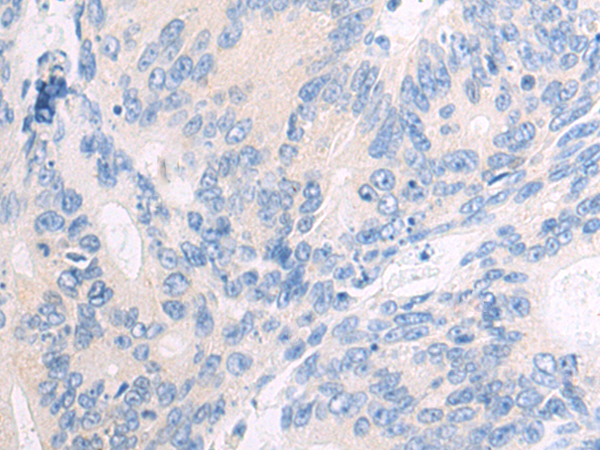 Anti-CDK6 Rabbit Polyclonal Antibody