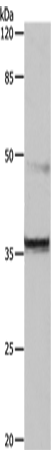 Anti-CDK6 Rabbit Polyclonal Antibody