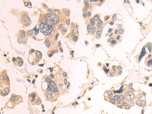 Anti-CDK10 Rabbit Polyclonal Antibody
