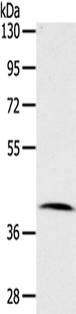 Anti-CDK10 Rabbit Polyclonal Antibody