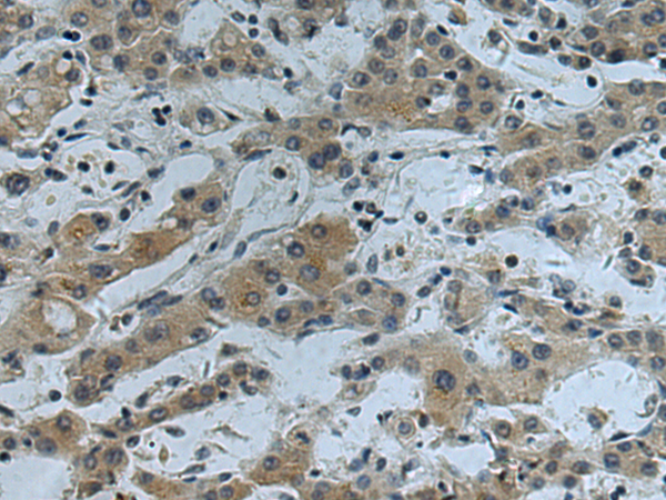 Anti-CHI3L1 Rabbit Polyclonal Antibody