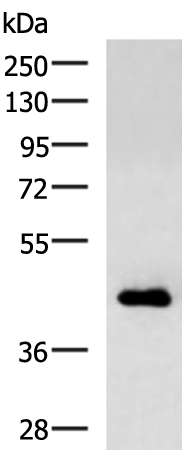 Anti-CHI3L1 Rabbit Polyclonal Antibody
