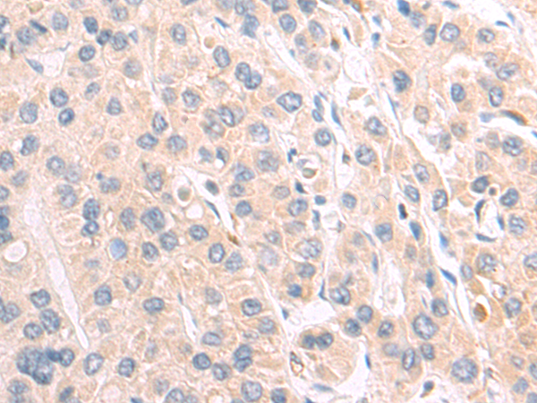 Anti-CLEC4D Rabbit Polyclonal Antibody