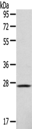 Anti-CLEC4D Rabbit Polyclonal Antibody