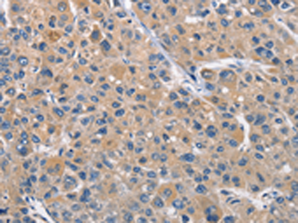Anti-CLEC2D Rabbit Polyclonal Antibody