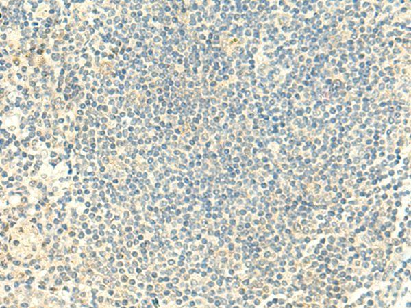 Anti-CLEC10A Rabbit Polyclonal Antibody