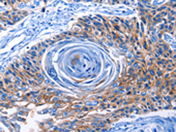 Anti-CLEC2B Rabbit Polyclonal Antibody