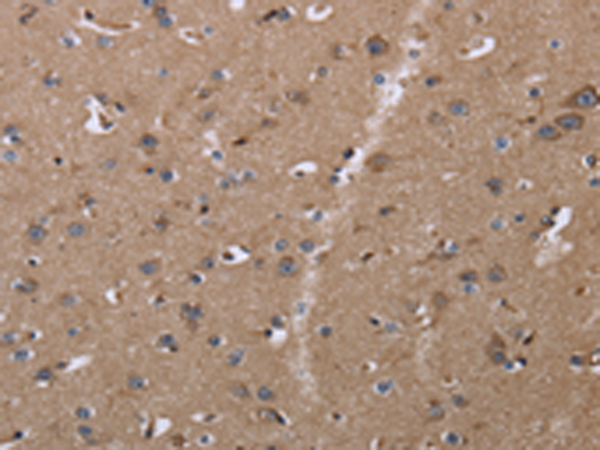 Anti-Claudin 23 Rabbit Polyclonal Antibody