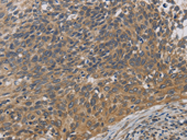 Anti-EMC8 Rabbit Polyclonal Antibody