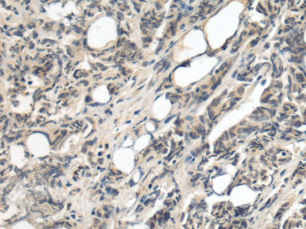 Anti-CCNJ Rabbit Polyclonal Antibody