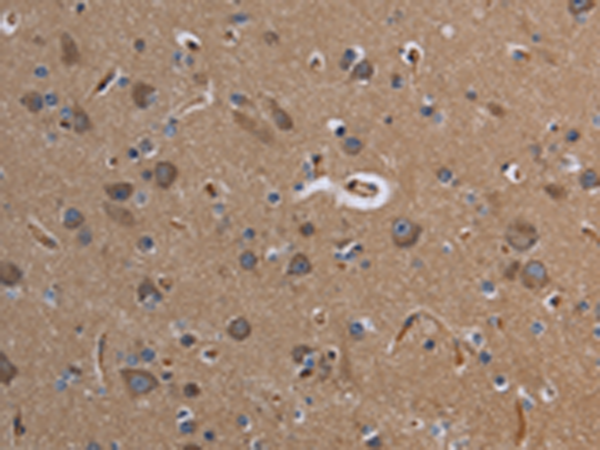 Anti-Cytochrome P450 3A4 Rabbit Polyclonal Antibody