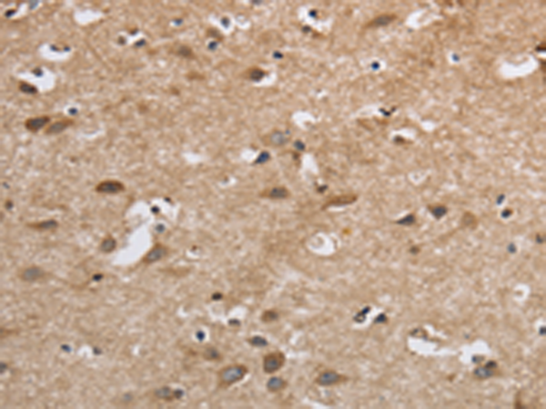 Anti-SDCCAG3 Rabbit Polyclonal Antibody