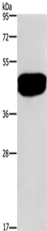 Anti-SDCCAG3 Rabbit Polyclonal Antibody