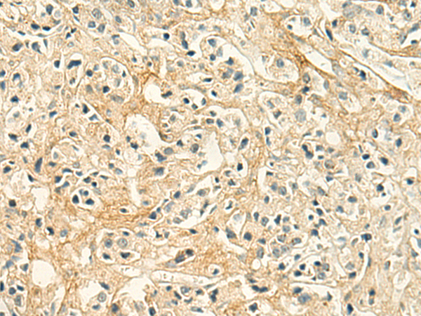 Anti-DCN Rabbit Polyclonal Antibody